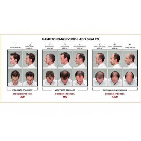 Ampulių kompleksas moterų plaukų slinkimui ir atauginimui CRESCINA TRANSDERMIC 100% 500 20vnt