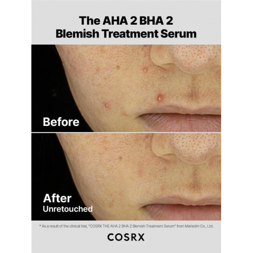 COSRX Serumas problematiškai odai The AHA 2 BHA 2 Blemish Treatment Serum