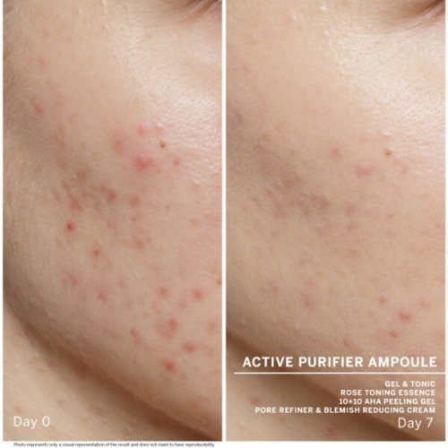 Babor Giliai valančios ampulės veidui probleminei odai Ampoule Concentrate Active Purifier