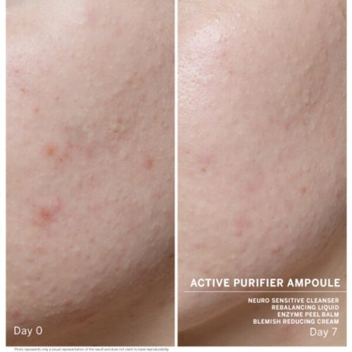 Babor Giliai valančios ampulės veidui probleminei odai Ampoule Concentrate Active Purifier