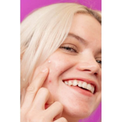 Dermalogica Gelis po bėrimų atsiradusioms dėmelėms šviesinti Post-Breakout Fix